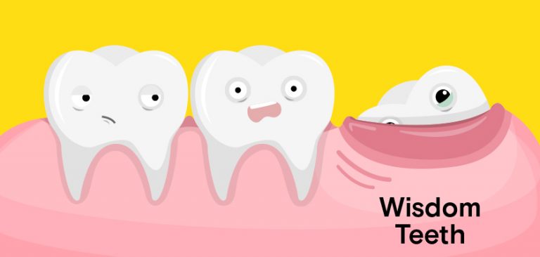 Wisdom Teeth Removal Cost Houston Wisdom Teeth Factory
