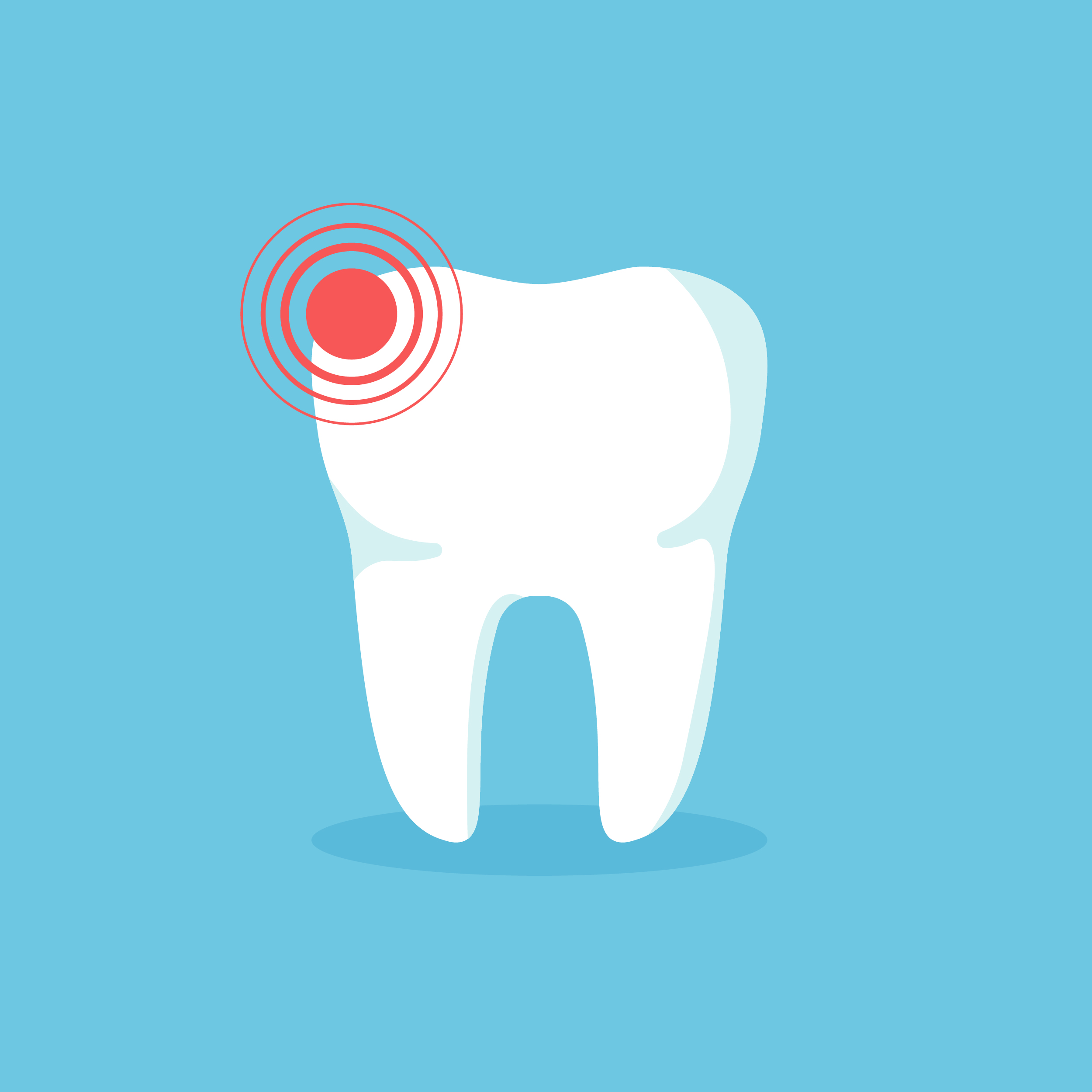 Emergency Wisdom Tooth Removal Houston
