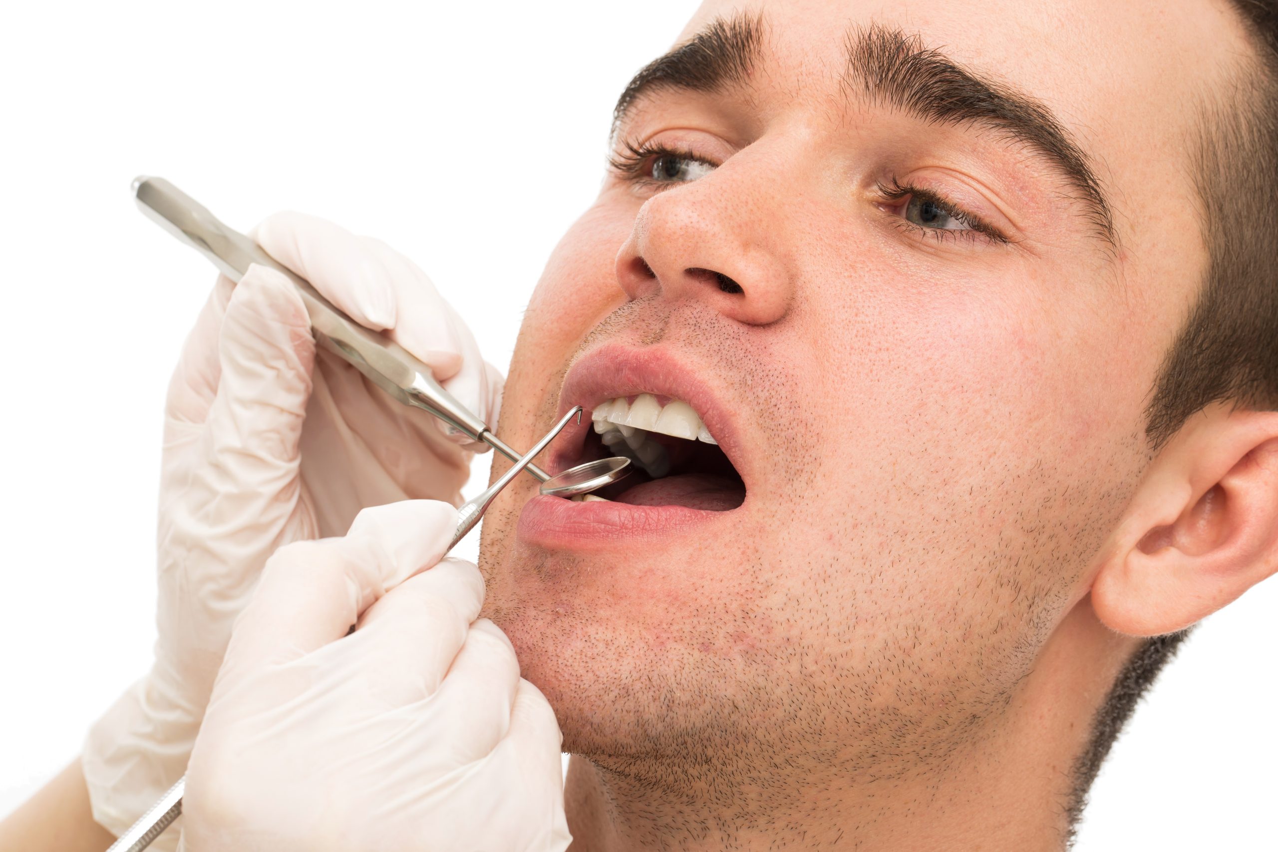 Wisdom Teeth Remove Recovery Timeline | Wisdom Teeth Factory