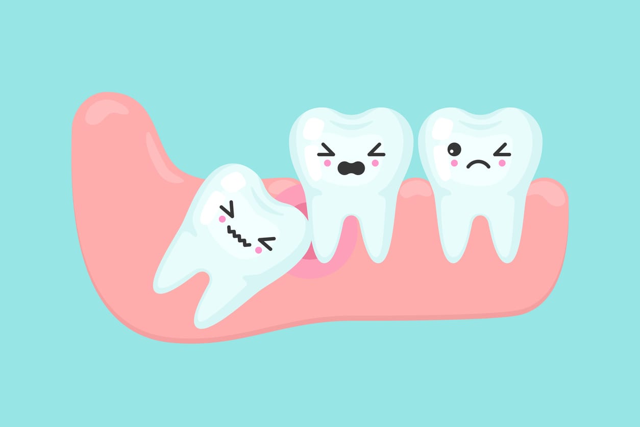 Wisdom Teeth Removal Aftercare | Wisdom Teeth Factory